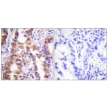 Immunohistochemistry - Anti-Tuberin Antibody (B0590) - Antibodies.com