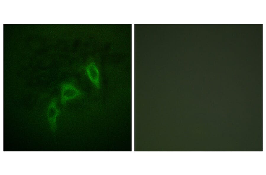 Immunofluorescence - Anti-Tuberin Antibody (B0590) - Antibodies.com