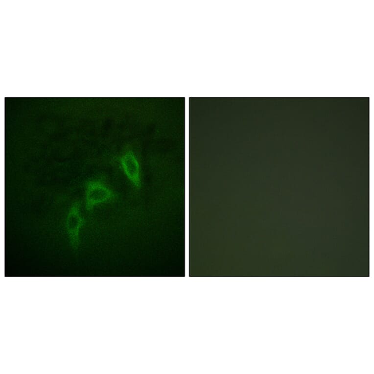 Immunofluorescence - Anti-Tuberin Antibody (B0590) - Antibodies.com