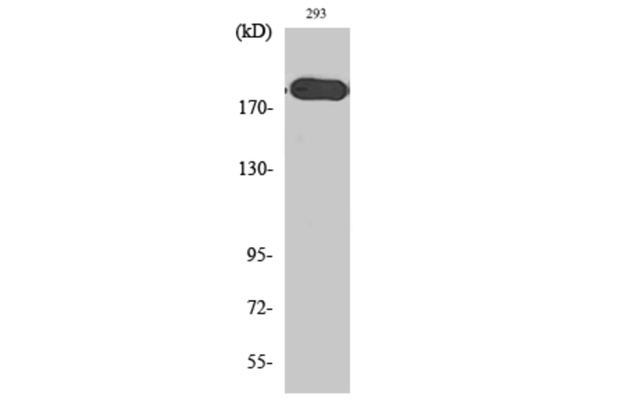 Western Blot - Anti-Tuberin Antibody (B0590) - Antibodies.com