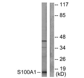 Western Blot - Anti-S100 A1 Antibody (C0318) - Antibodies.com