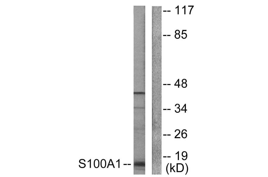 Western Blot - Anti-S100 A1 Antibody (C0318) - Antibodies.com