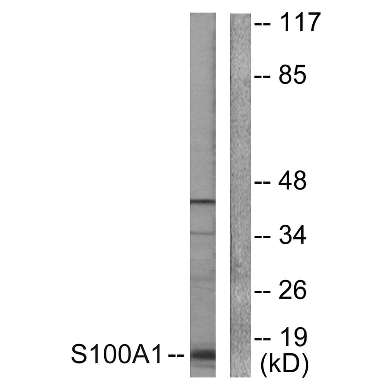 Western Blot - Anti-S100 A1 Antibody (C0318) - Antibodies.com