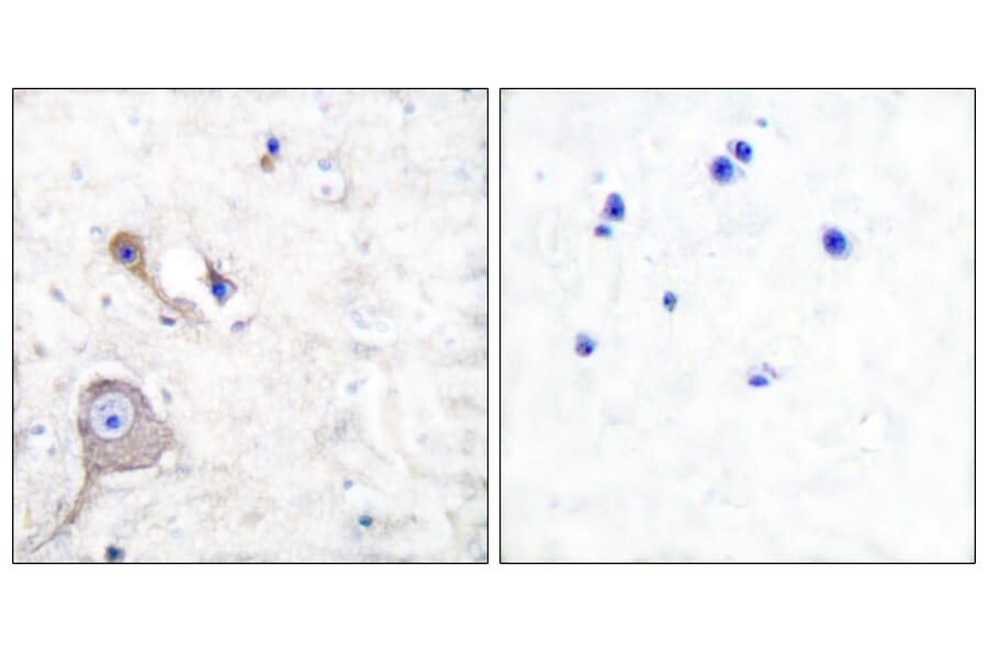 Immunohistochemistry - Anti-S100 A1 Antibody (C0318) - Antibodies.com