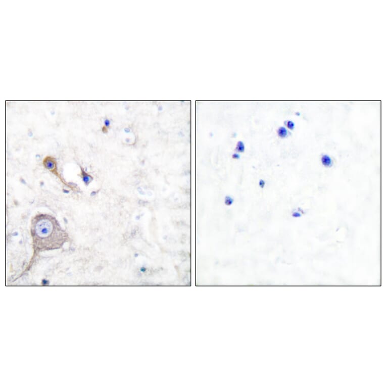 Immunohistochemistry - Anti-S100 A1 Antibody (C0318) - Antibodies.com