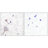 Immunohistochemistry - Anti-S100 A1 Antibody (C0318) - Antibodies.com