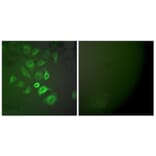 Immunofluorescence - Anti-S100 A1 Antibody (C0318) - Antibodies.com