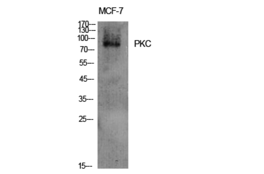 Western Blot - Anti-PKC-pan Antibody (B0803) - Antibodies.com