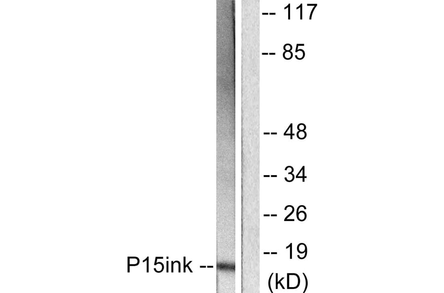 Western Blot - Anti-p15 INK Antibody (C0287) - Antibodies.com