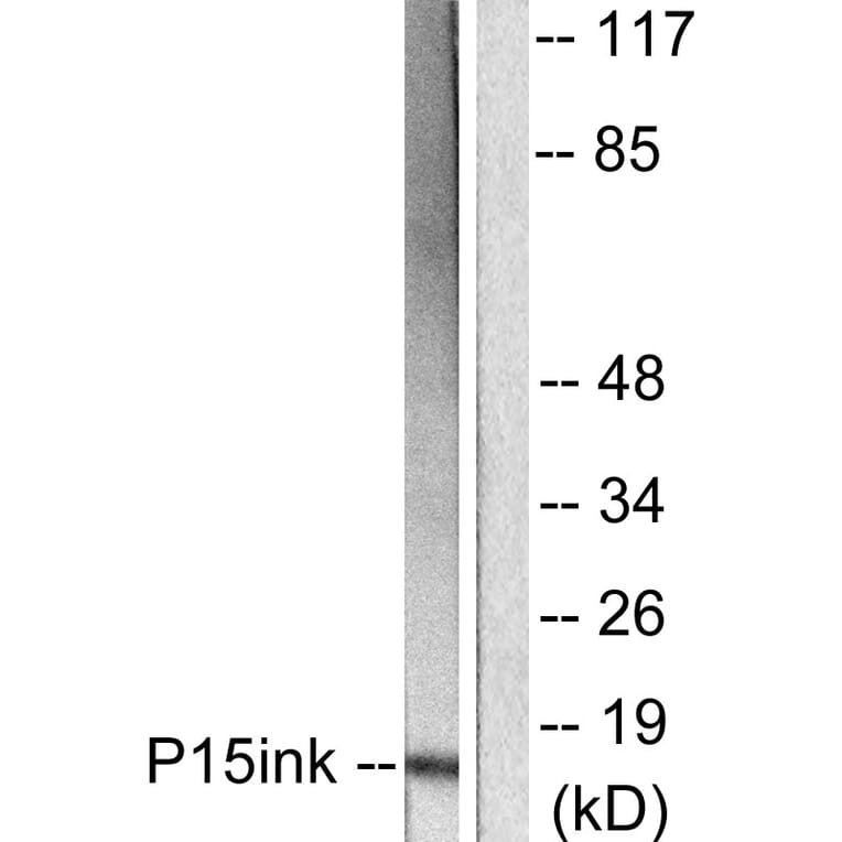 Western Blot - Anti-p15 INK Antibody (C0287) - Antibodies.com