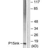 Western Blot - Anti-p15 INK Antibody (C0287) - Antibodies.com