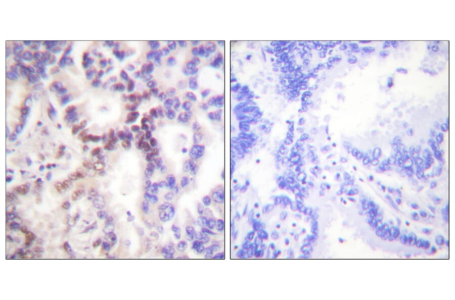 Immunohistochemistry - Anti-p15 INK Antibody (C0287) - Antibodies.com