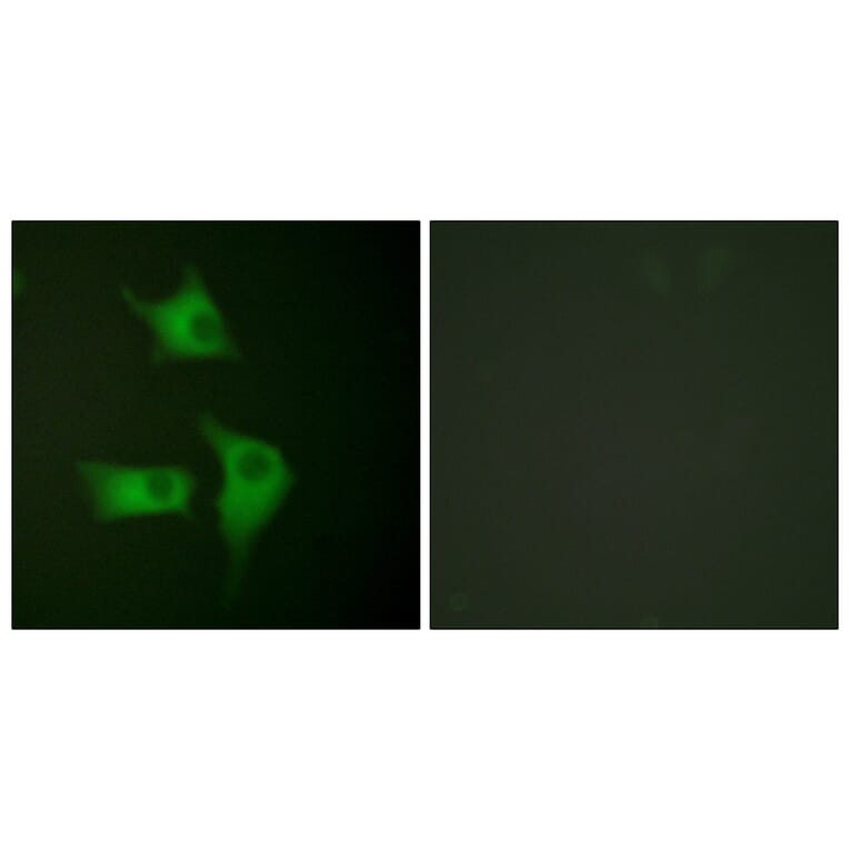 Immunofluorescence - Anti-p15 INK Antibody (C0287) - Antibodies.com