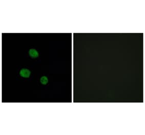 Immunofluorescence - Anti-hnRNP M Antibody (C10693) - Antibodies.com