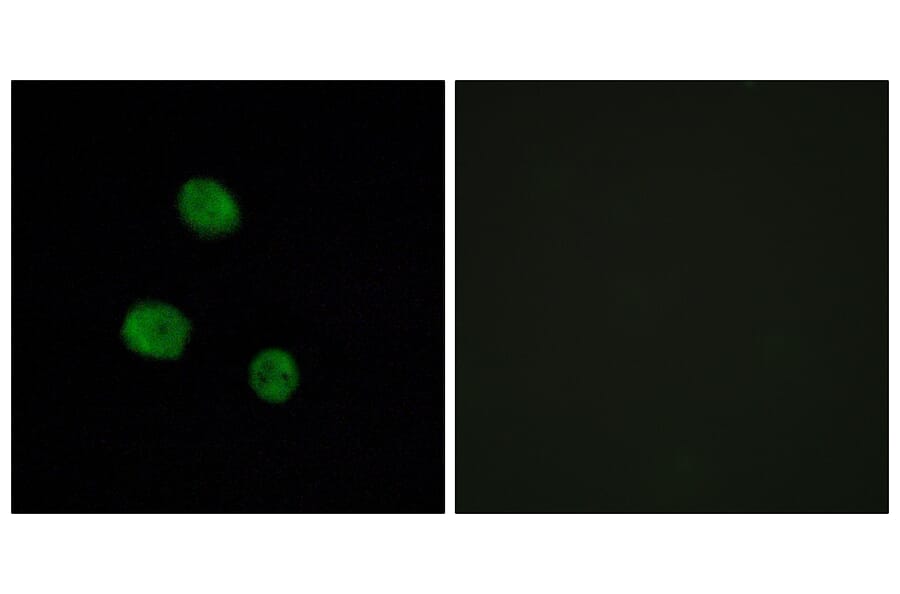 Immunofluorescence - Anti-hnRNP M Antibody (C10693) - Antibodies.com
