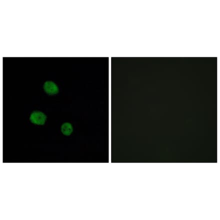 Immunofluorescence - Anti-hnRNP M Antibody (C10693) - Antibodies.com
