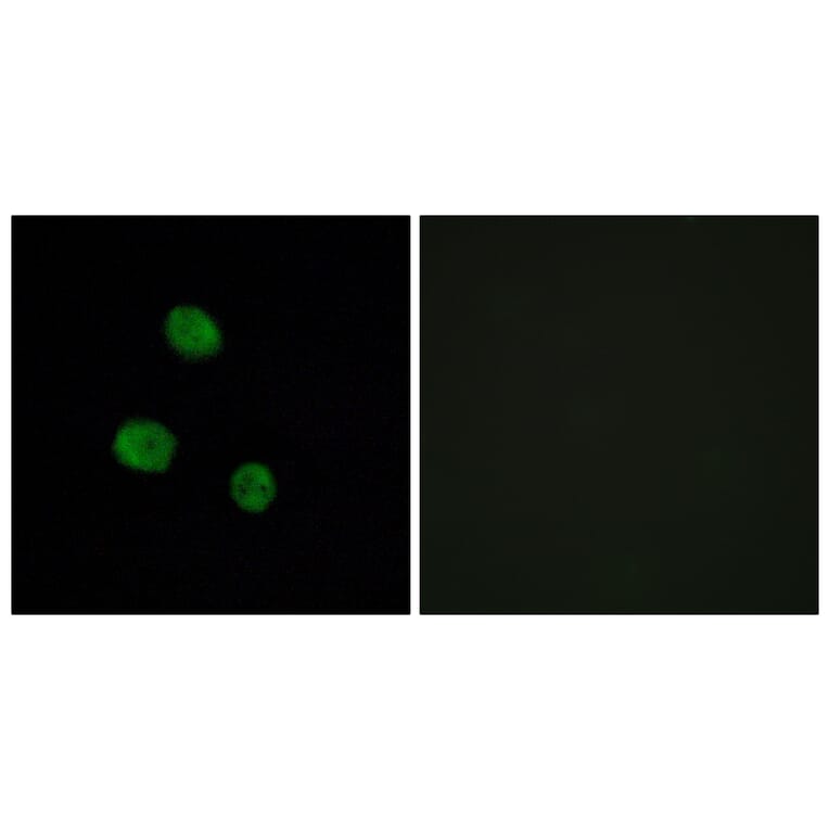 Immunofluorescence - Anti-hnRNP M Antibody (C10693) - Antibodies.com