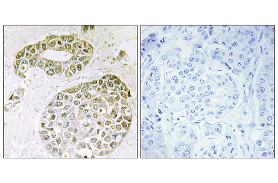 Immunohistochemistry - Anti-hnRNP M Antibody (C10693) - Antibodies.com