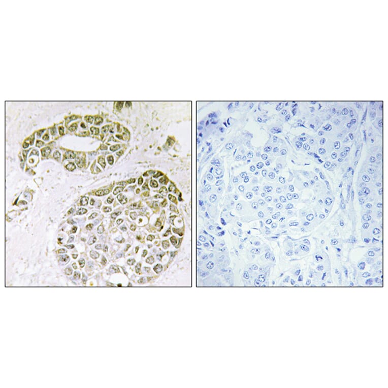 Immunohistochemistry - Anti-hnRNP M Antibody (C10693) - Antibodies.com