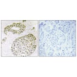Immunohistochemistry - Anti-hnRNP M Antibody (C10693) - Antibodies.com