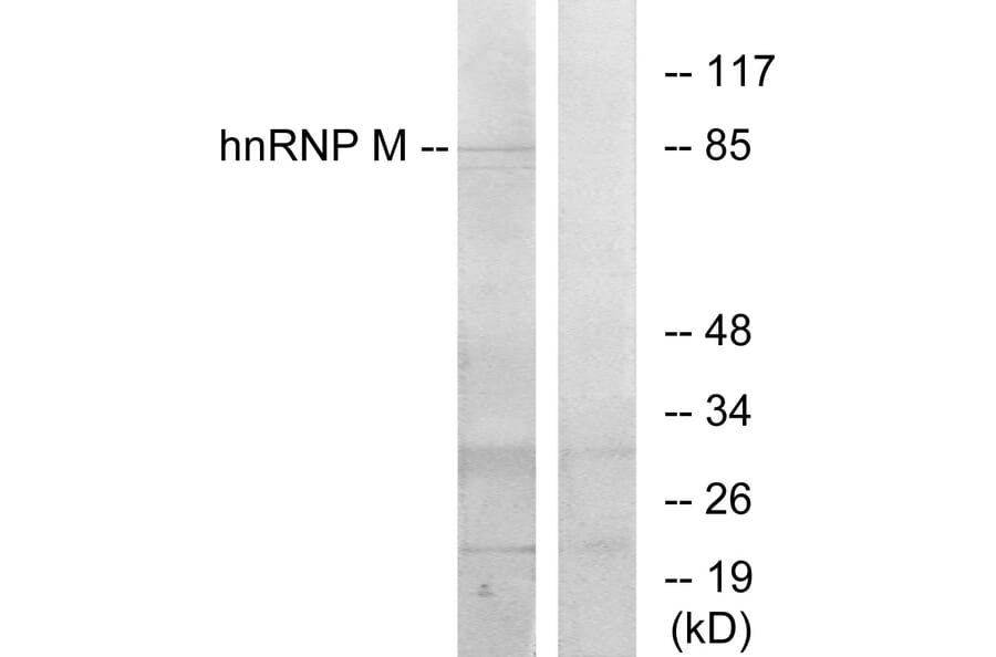 Western Blot - Anti-hnRNP M Antibody (C10693) - Antibodies.com