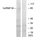 Western Blot - Anti-hnRNP M Antibody (C10693) - Antibodies.com