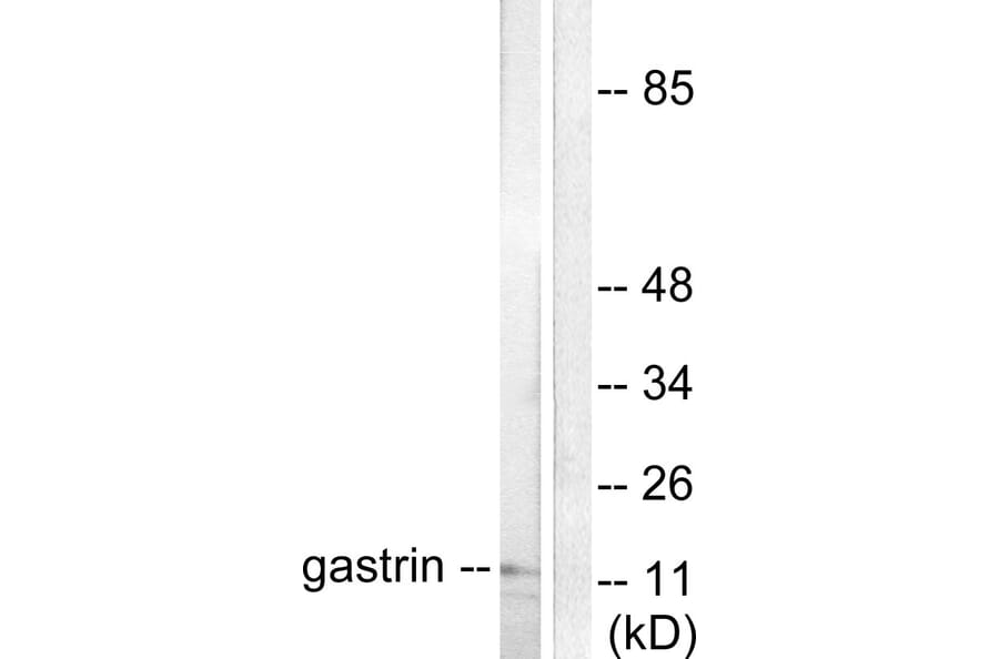 Western Blot - Anti-Gastrin Antibody (C0205) - Antibodies.com