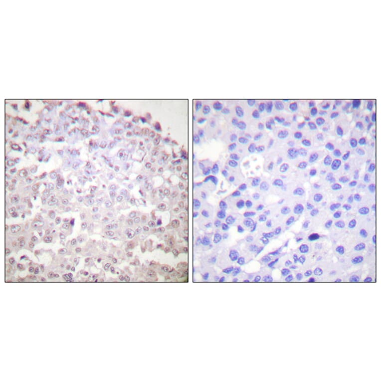 Immunohistochemistry - Anti-GADD153 Antibody (C0202) - Antibodies.com