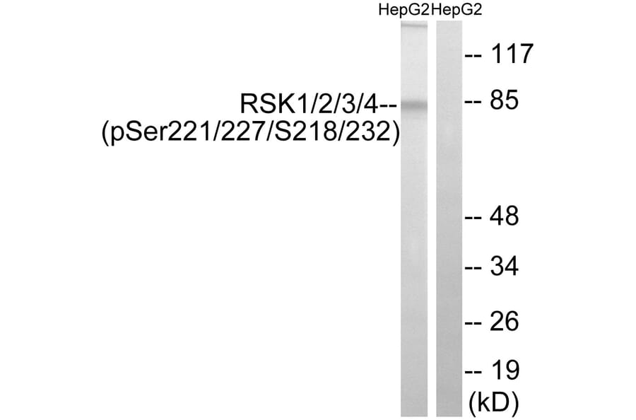 Western Blot - Anti-RSK1 + RSK2 + RSK3 + RSK4 (phospho Ser221 + Ser227 + Ser218 + Ser232) Antibody (A8182) - Antibodies.com
