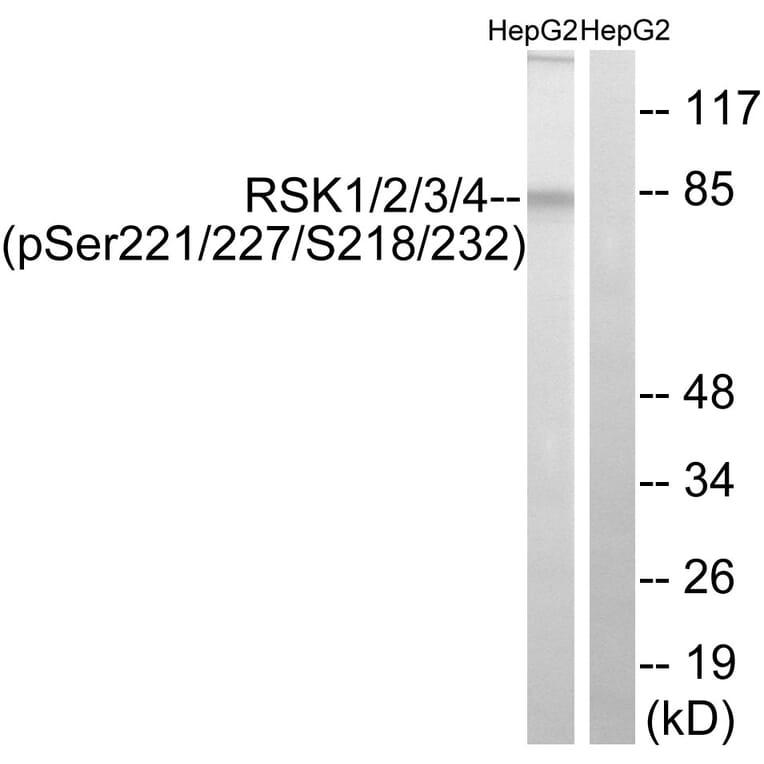 Western Blot - Anti-RSK1 + RSK2 + RSK3 + RSK4 (phospho Ser221 + Ser227 + Ser218 + Ser232) Antibody (A8182) - Antibodies.com