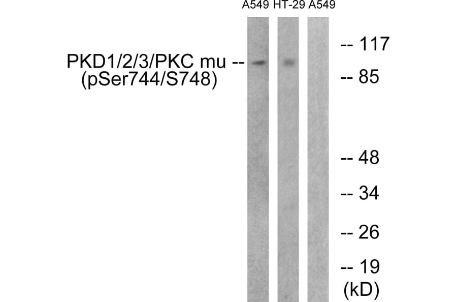 Western Blot - Anti-PKD1 + PKD2 + PKD3 (phospho Ser738 + Ser742) Antibody (A0720) - Antibodies.com