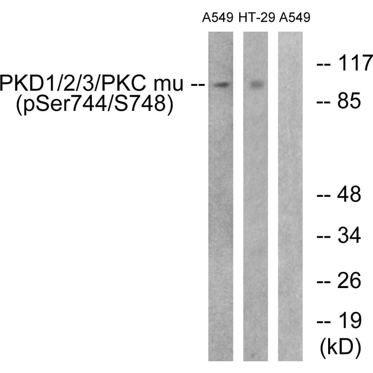 Western Blot - Anti-PKD1 + PKD2 + PKD3 (phospho Ser738 + Ser742) Antibody (A0720) - Antibodies.com