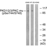 Western Blot - Anti-PKD1 + PKD2 + PKD3 (phospho Ser738 + Ser742) Antibody (A0720) - Antibodies.com