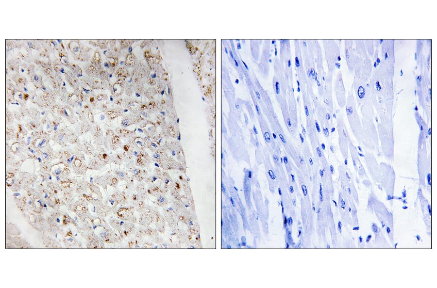 Immunohistochemistry - Anti-PKD1 + PKD2 + PKD3 (phospho Ser738 + Ser742) Antibody (A0720) - Antibodies.com