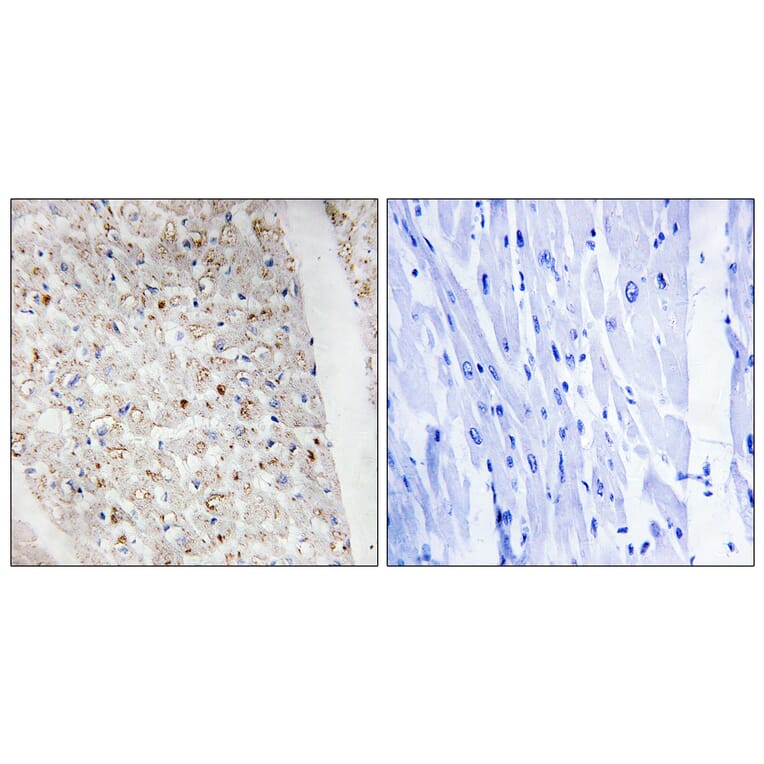 Immunohistochemistry - Anti-PKD1 + PKD2 + PKD3 (phospho Ser738 + Ser742) Antibody (A0720) - Antibodies.com