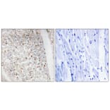 Immunohistochemistry - Anti-PKD1 + PKD2 + PKD3 (phospho Ser738 + Ser742) Antibody (A0720) - Antibodies.com