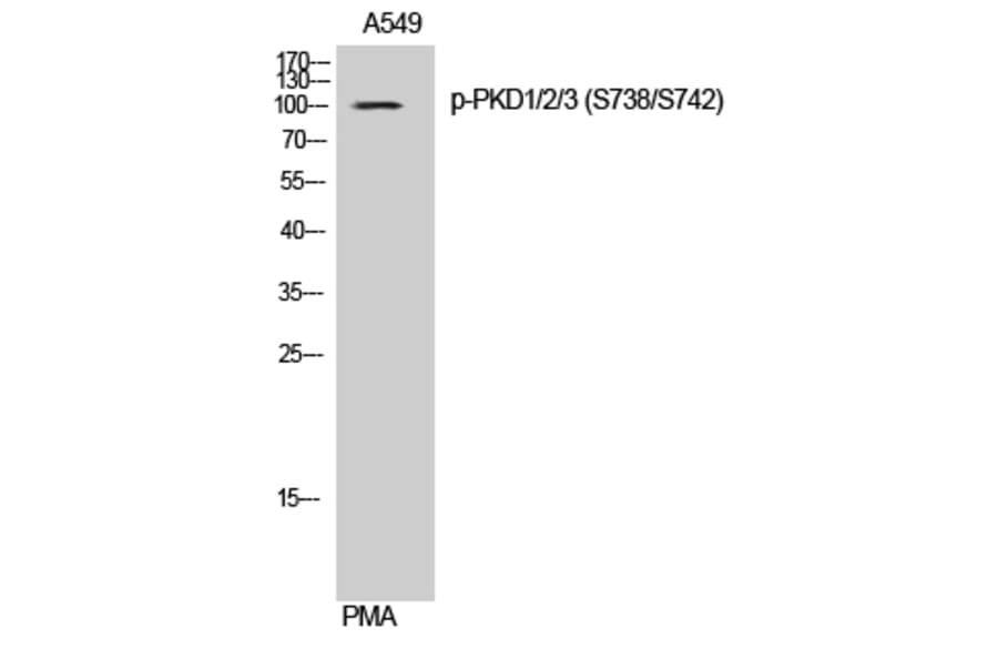 Western Blot - Anti-PKD1 + PKD2 + PKD3 (phospho Ser738 + Ser742) Antibody (A0720) - Antibodies.com