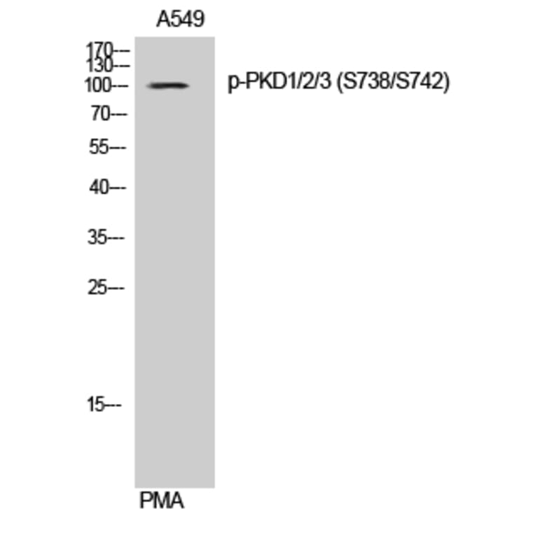 Western Blot - Anti-PKD1 + PKD2 + PKD3 (phospho Ser738 + Ser742) Antibody (A0720) - Antibodies.com