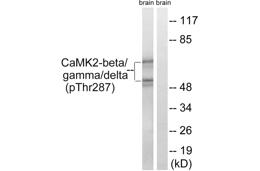 Western Blot - Anti-CaMK2 beta + gamma + delta (phospho Thr287) Antibody (A8085) - Antibodies.com