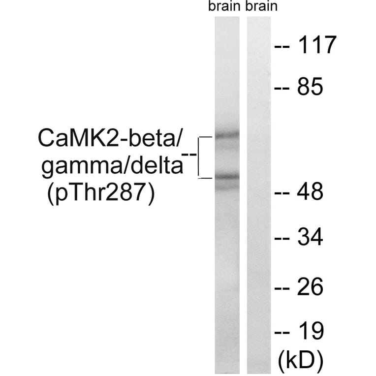 Western Blot - Anti-CaMK2 beta + gamma + delta (phospho Thr287) Antibody (A8085) - Antibodies.com
