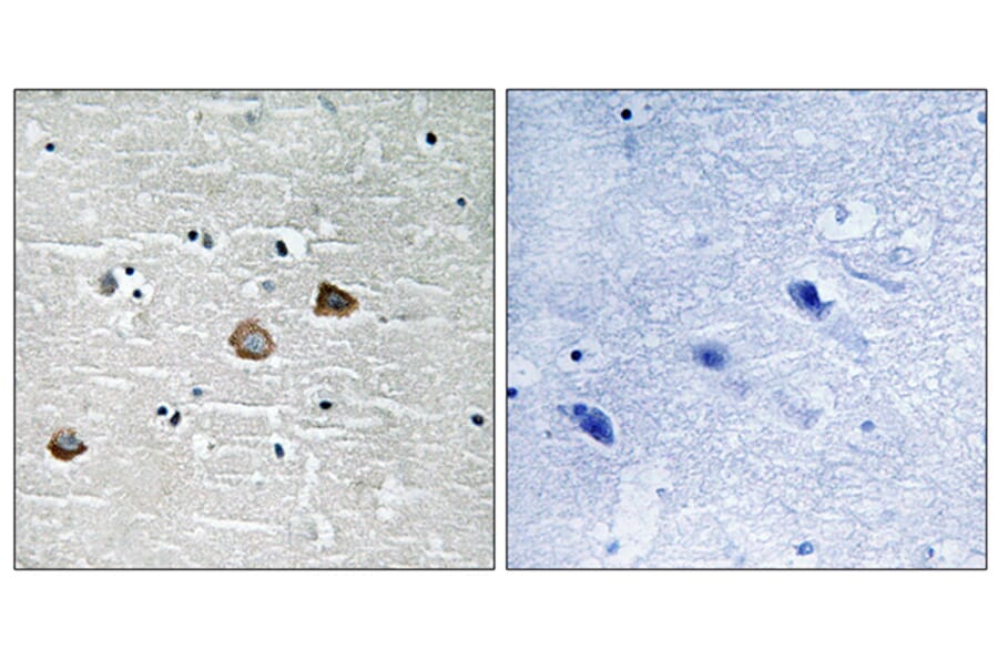 Immunohistochemistry - Anti-CaMK2 beta + gamma + delta (phospho Thr287) Antibody (A8085) - Antibodies.com