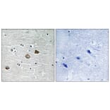 Immunohistochemistry - Anti-CaMK2 beta + gamma + delta (phospho Thr287) Antibody (A8085) - Antibodies.com