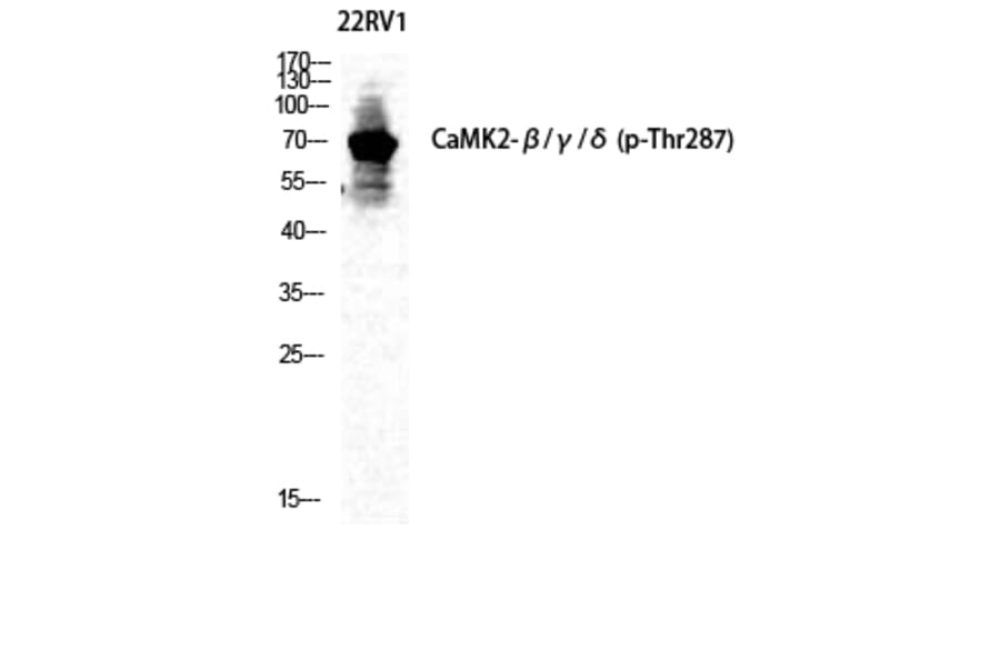 Western Blot - Anti-CaMK2 beta + gamma + delta (phospho Thr287) Antibody (A8085) - Antibodies.com