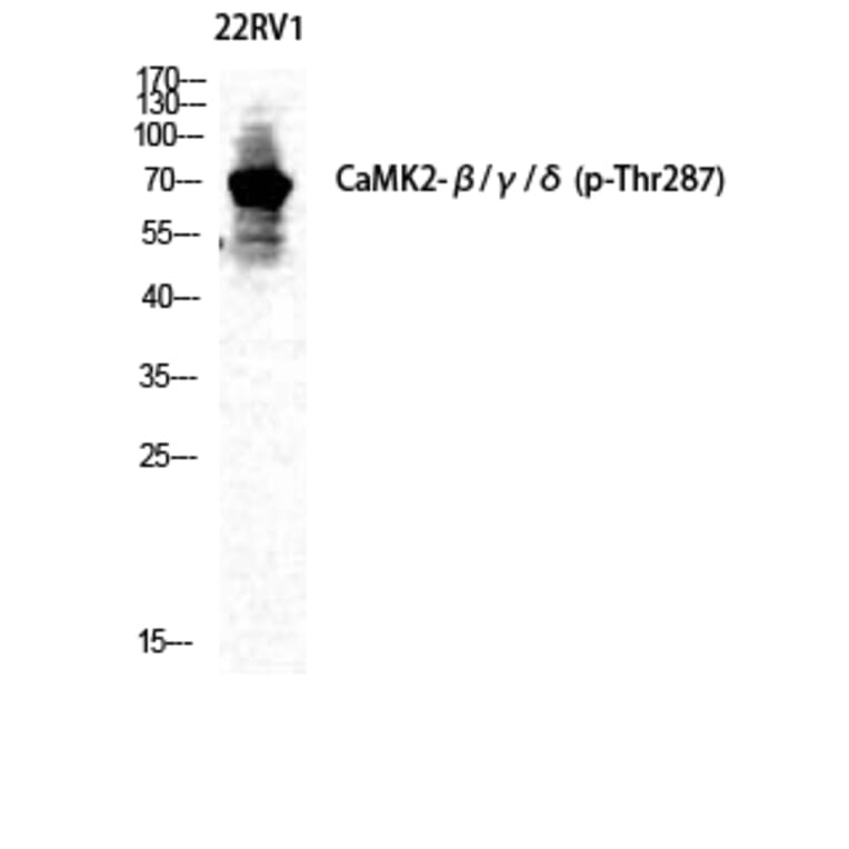 Western Blot - Anti-CaMK2 beta + gamma + delta (phospho Thr287) Antibody (A8085) - Antibodies.com