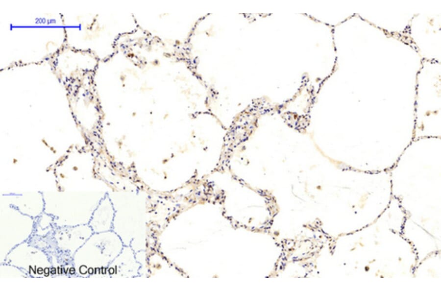 Immunohistochemistry - Anti-CaMK2 beta + gamma + delta (phospho Thr287) Antibody (A8085) - Antibodies.com