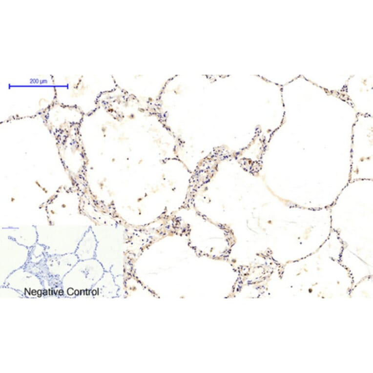 Immunohistochemistry - Anti-CaMK2 beta + gamma + delta (phospho Thr287) Antibody (A8085) - Antibodies.com