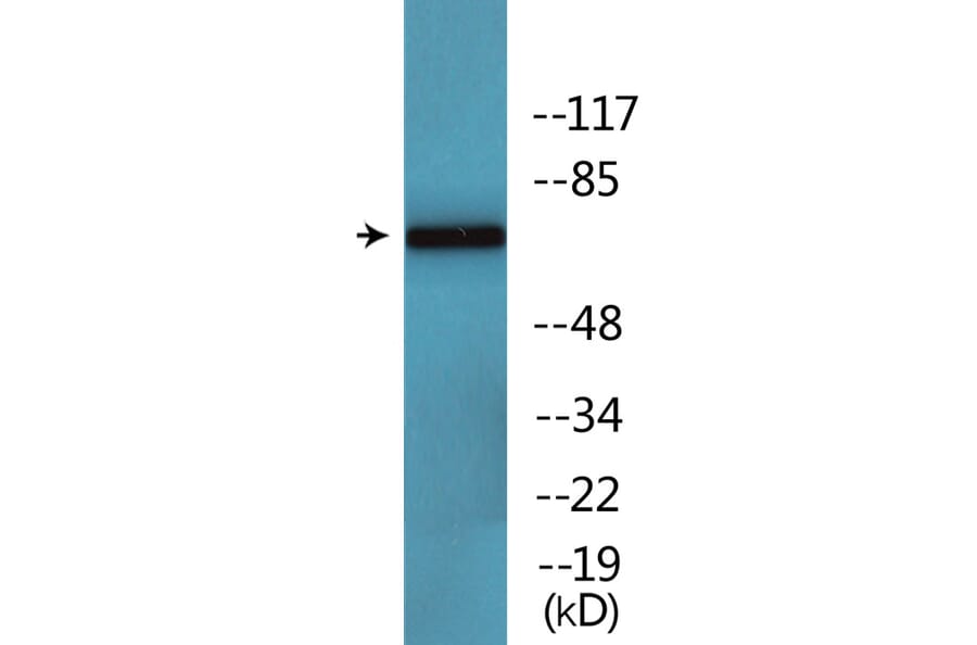 Western Blot - Anti-CaMK2 beta + gamma + delta (phospho Thr287) Antibody (P12-1084) - Antibodies.com