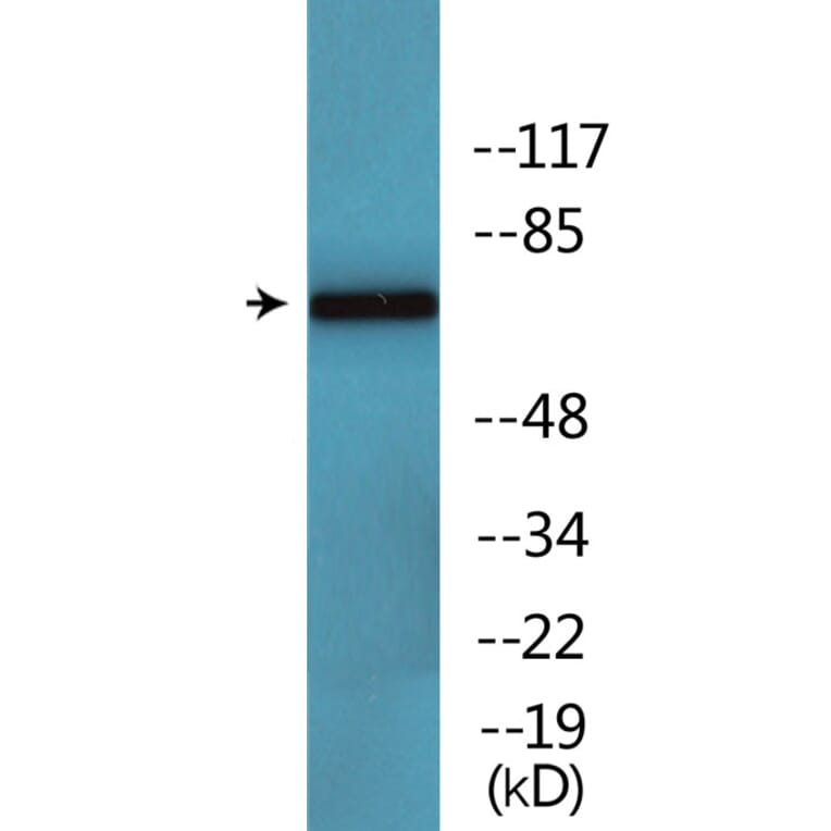 Western Blot - Anti-CaMK2 beta + gamma + delta (phospho Thr287) Antibody (P12-1084) - Antibodies.com