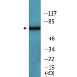 Western Blot - Anti-CaMK2 beta + gamma + delta (phospho Thr287) Antibody (P12-1084) - Antibodies.com