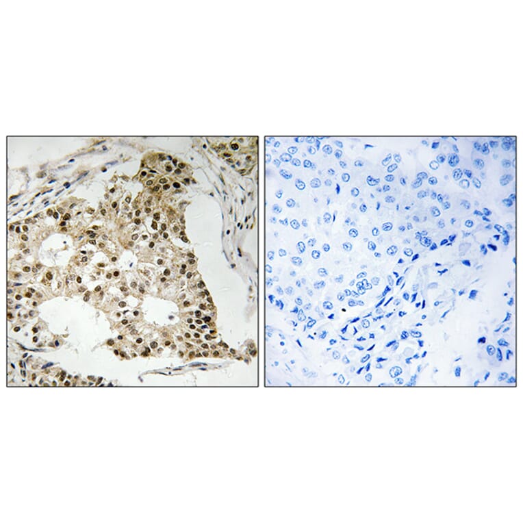 Immunohistochemistry - Anti-Retinoic Acid Receptor alpha (phospho Ser77) Antibody (A8217) - Antibodies.com